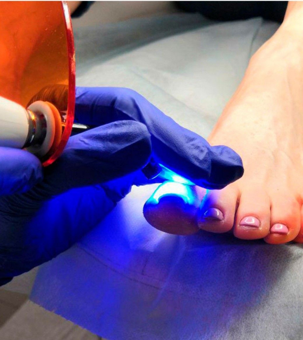 Pedicure Clínico en Santa Marta - Centro de Podología Pedi-Spa